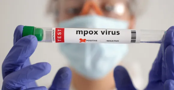 éprouvette avec le virus mpox