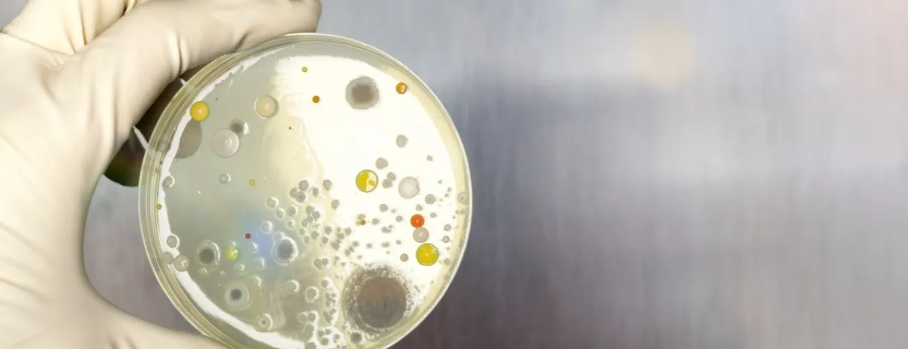 échantillon bactéries 