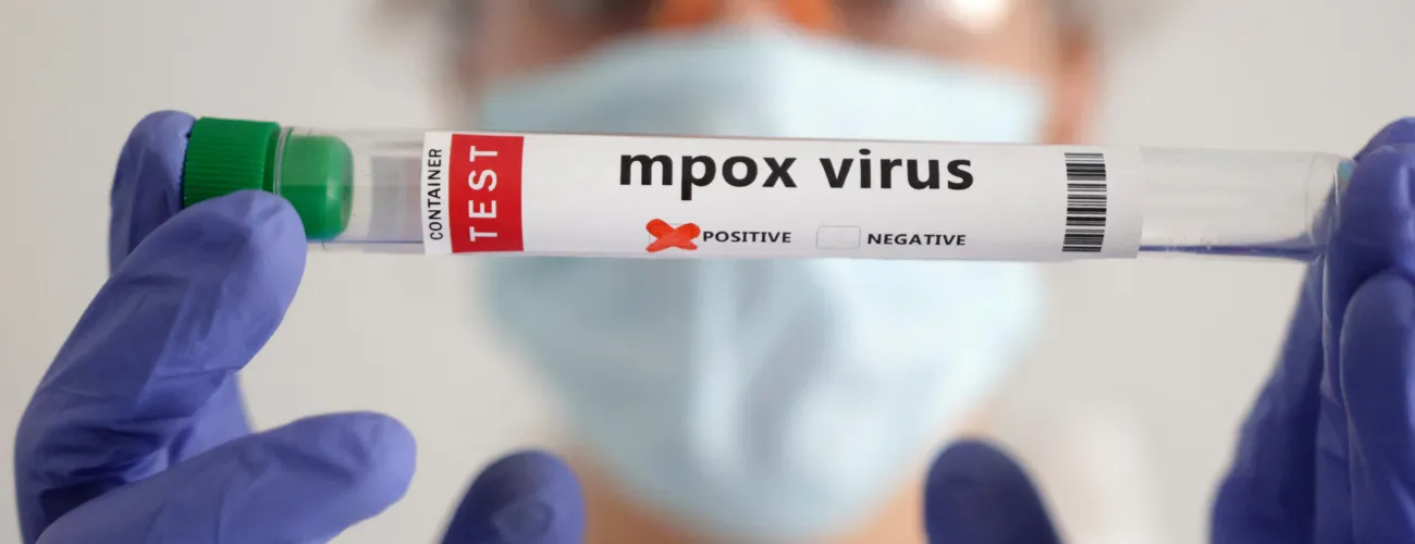 éprouvette avec le virus mpox