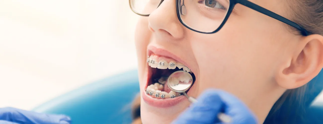 Une enfant chez l'orthodontiste