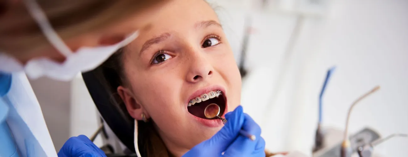 Une enfant est chez l'orthodontiste et montre ses dents et son appareil.
